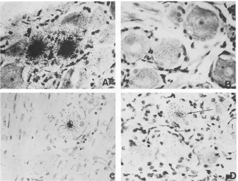 FIG. 5.from(D)complementoligonucleotidesrabbitsLatently In situ hybridization of trigeminal ganglia from latently infected rabbits