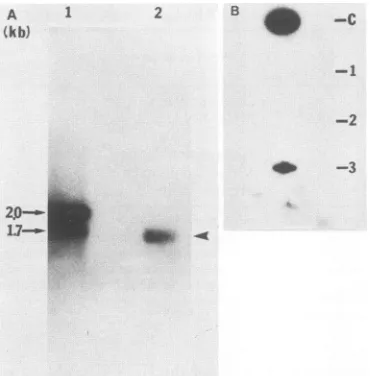 FIG. 9.fromdescribedRNA.labeledRNAhepatitis patient.thenextractedmembrane2.0insertsofantiserum.bycipitatedtranscribedantiserumSlot HDV Analysis of HDV RNA from the plasma of a delta (A) Northern (RNA) blot analysis of the HDV HDV RNA (lane 2) was prepared 