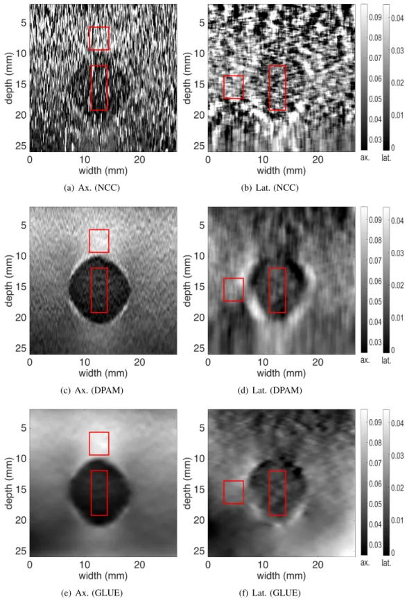 Figure 2.4: Results of the phantom experiment. Axial and lateral strain images as well as the target and background windows (in red) for calculation of SNR and CNR are shown (see Table 2.3 for results)