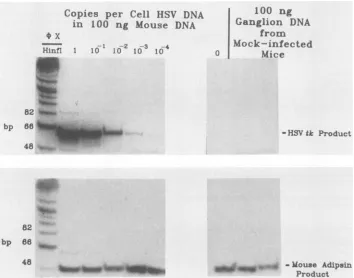 FIG.1.oligonucleotideofpgwereDNAproductsDNAspecific the Quantitative PCR analysis of HSV DNA