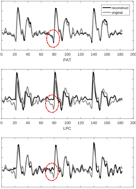 Figure 3.4: Signal reconstruct compared against original. Red circles highlight the anti-causal component that PAT can capture, but LPC or STRAIGHT cannot.