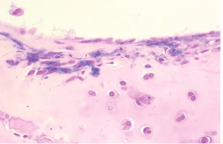 Figure 5. The violet cells are rat mesenchymal stromal cells, which are transgenic for the human placental alkaline phosphatase, in the knee joint of a bone marrow-transplanted, marker tolerant rat knee
