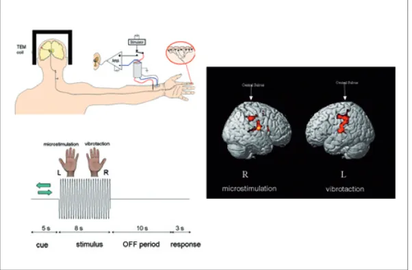 Figure 5: Microstimulation and vibration studies of human somatosensation using magnetic resonance imaging techniques