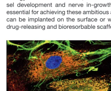 Figure 4. Basic biology of nerve in-growth: Cortical neurons in f uorescence microscopy after staining with anti-Tau antibodies (green) and DAPI (blue nuclei)