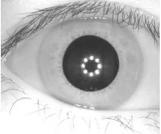 Figure 1: Iris Image 