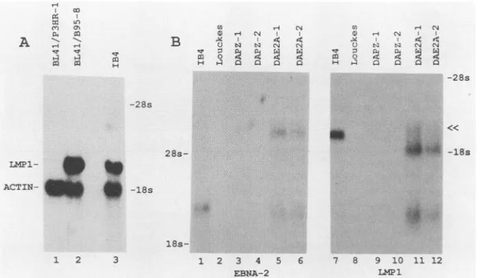 FIG. 4.orend.(DAPZ-1,loadedLMP1 a Northern blots of P3HR-1- or B95-8-infected BL41 cells (A) or Daudi EB1NA2 transfectants (B)