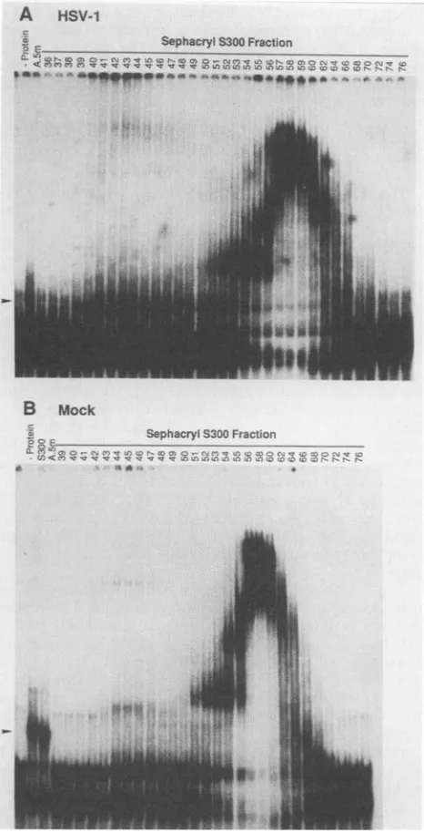 FIG. 5.pRB3881 Autoradiographic images of complexes formed between T7 transcript probe and various protein samples in gel shift