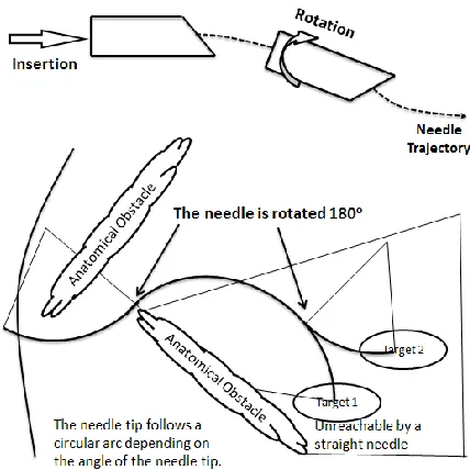 Figure 2.3 Needle steering mechanism [Webster 2006] 