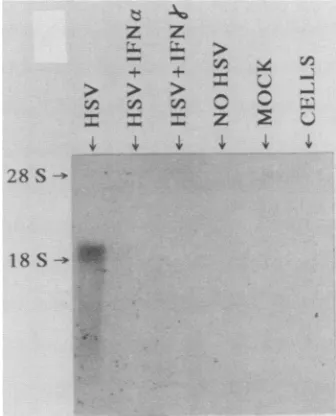 Figure 4extracted shows a Northern blot analysis of the total RNAs from transfected~~~ cells and probed with a 3p_
