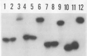 FIG. 2.growngrownDH5a.M-MuLVpreparedpyranosideparticlesamide3,(B)panelrectedandpositions DH5a(pIF) Expression of the M-MuLV IN coding domain in E