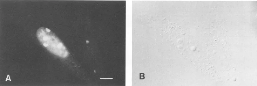 FIG. 8.anti-nsP2exposed Immunofluorescence of BHK cells transfected with the plasmid pSV-NS2 containing cDNA encoding full-length nsP2