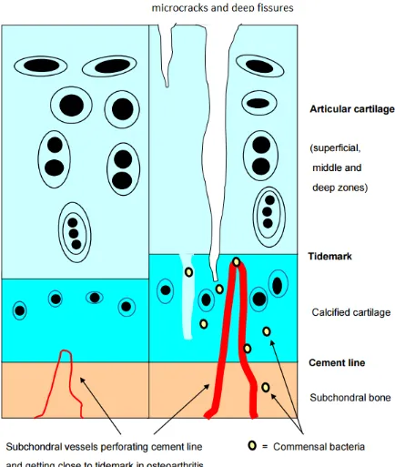 Figure 1 Within the calcified zone of core areas, voluminous pieces of permanent cartilage are metabolically supplied via vascular channels