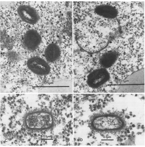 FIG. 5.Materials Electron micrographs of oocytes injected with RPV. Oocytes were injected and prepared for electron microscopy as described in and Methods