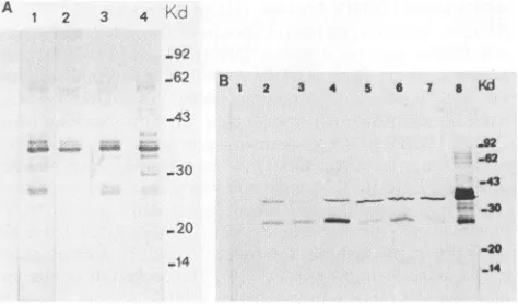 FIG.1.Partiallyrespectively).avianDHBVHHBV1 to Immunoblot analysis of envelope proteins of different hepadnavirus strains with monoclonal antibody SD20