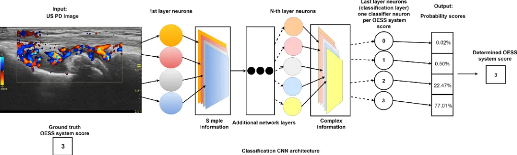 Figure 1 Illustration of convolutional neural network (CNN) automatically scoring Outcome Measures in Rheumatology (OMERACT)-EULAR disease activity on an ultrasound (US) image