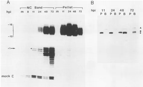 FIG. 6.cellsTheMethods).riboprobe.shownp.g Time course of appearance of the truncated S mRNA