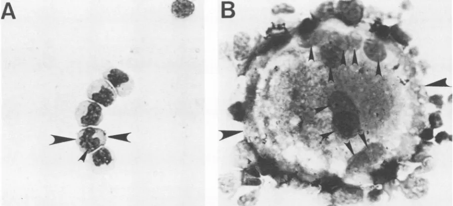 FIG. 4.fromrabbit.BLV-infecteddividedlinescontrol Typical growth in continuous culture of PBMC from and control rabbits