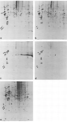 FIG. 2.Ad5(pymT)-infectednonstarredofcells,immunoprecipitates"S-labeled actin Comparison on 2D gels of the MTAPs from human and rodent cells