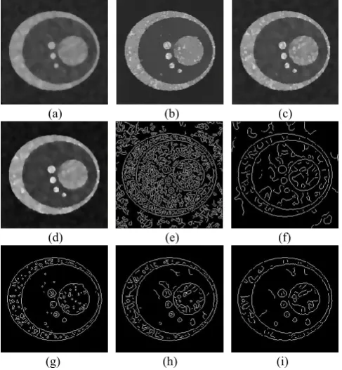 Fig.5. The speckle reduction and edge map results (Yue et al.[12], 