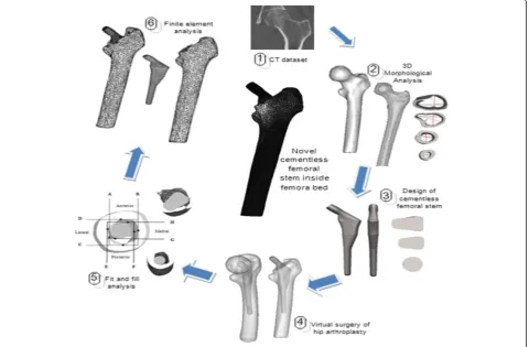 Figure 1 Summarize steps of designing the cementless hip arthroplasty.
