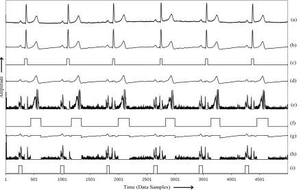 Fig. 2 Results obtained at each step of the algorithm, (a) Raw ECG, (b) Filtered ECG, (c) QRS locations, 