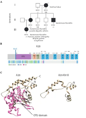 Figure 1 Phenotypic and protein-level characteristics of a family with newly identified TNFAIP3 c.A271T: p.(Lys91*) mutation