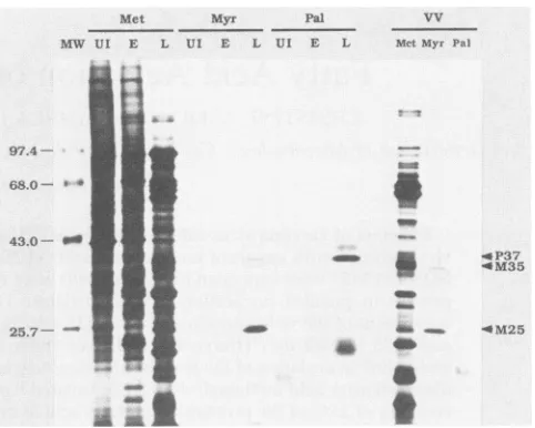 FIG.1.labeledacidchymotrypsininfection.intracellular(M35)electrophoresisfluorography.was(L,monolayersbovinelarlabeled SDS-polyacrylamide gel electrophoresis of metabolically proteins