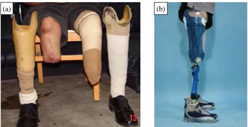 Figure 1.1: Example for (a) a patient with residual limb below the knee [5], and (b) 