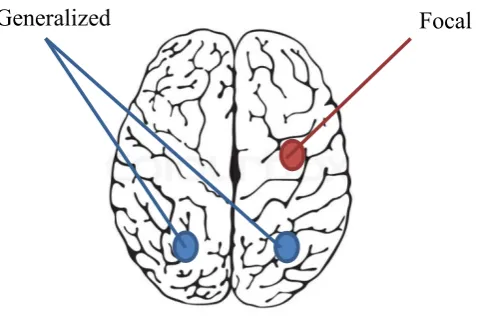 Figure 1.1: Location of onset for focal and generalized seizure. 