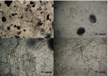 Figure 4. pristine mPE-nHA, 12 hnanocomposite, respectively; (Figure4. 100× and 500× image using 3D Hirox digital microscopy. (A–C) are the 100× image of pristine mPE‐nHA, 12 h Aloe vera dip‐coated mPE‐nHA and 24 h Aloe vera dip‐coated mPE‐nHA nanocomposit