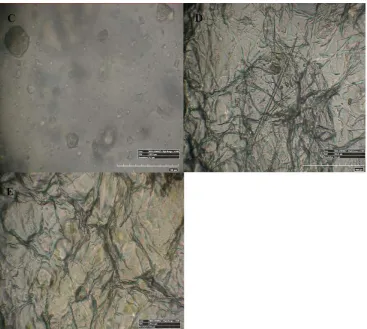 Figure 5.Figure 5. 50×, 100× and 1000× image using 3D Hirox digital microscopy. (A) nHA nanorod distribution in pristine mPE‐nHA at 50×; (B) Thickness of Aloe vera coating in 24 h Aloe vera dip‐coated mPE‐nHA at  100×;  (C–E)  are  1000×  images  of  untreated  mPE‐nHA,  and  12  and  24  h  Aloe  vera  dip‐coated   mPE50‐nHA,×, 100 respectively.× and 1000 × image using 3D Hirox digital microscopy.(A) nHA nanoroddistribution in pristine mPE-nHA at 50×; (B) Thickness of Aloe vera coating in 24 h Aloe vera dip-coatedmPE-nHA at 100×; (C–E) are 1000× images of untreated mPE-nHA, and 12 and 24 h Aloe veradip-coated mPE-nHA, respectively.Figure 5. 50×, 100× and 1000× image using 3D Hirox digital microscopy. (A) nHA nanorod distribution in pristine mPE‐nHA at 50×; (B) Thickness of Aloe vera coating in 24 h Aloe vera dip‐coated mPE‐nHA at  100×;  (C–E)  are  1000×  images  of  untreated  mPE‐nHA,  and  12  and  24  h  Aloe  vera  dip‐coated   mPE‐nHA, respectively. 