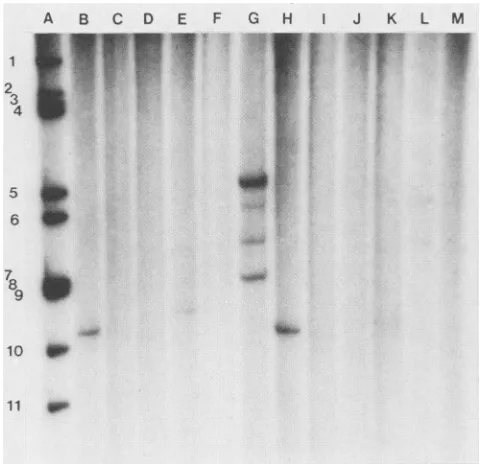 FIG.3.VP4 Comparison of amino acid residues critical to cross-reactive neutralization epitopes on VP4 of human rotavirus strains