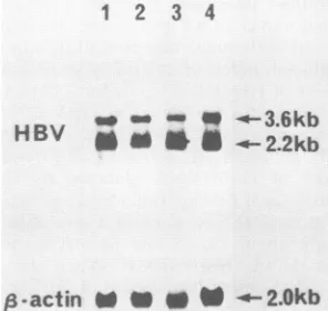 FIG.3.wereHep-HB107untreatedHB107IFN-,B Northern (RNA) blot analysis of HBV mRNAs from cells