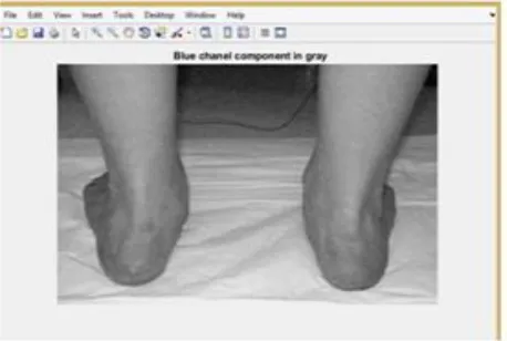 Fig. 5. Gray Image Conversion 