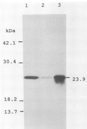 FIG. 2.fection.ofof23.9carbonicbyinzyme,sodiumchuckImmobilonmarkerssample'251-labeled pSVL