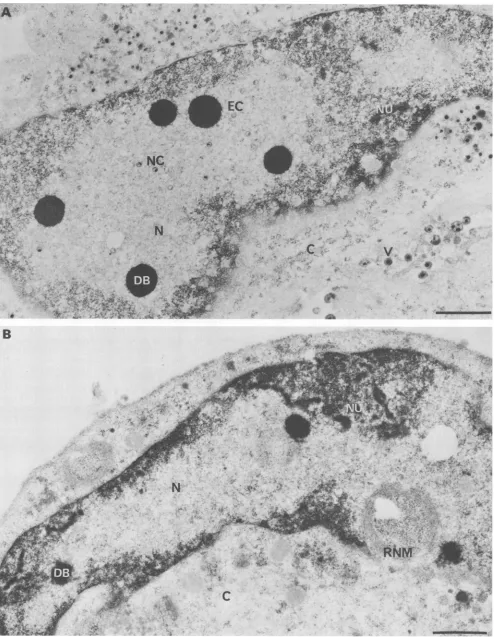 FIG. 4.withacetatenucleoplasm; Electron micrographs of infected cells late in the growth cycle at the nonpermissive temperature