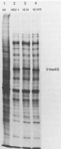 TABLE 3. Titration of wt HSV-1, in1814, and 1814R on BHKcells transfected with pUC9 or plll (encoding VmwllO)