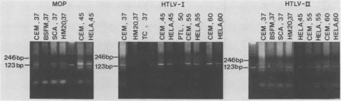 FIG. 4.transcriptase-relatedbroadareishumanshownHeLa present Electrophoretic analysis of products from 25 polymerase chain reactions with seven human DNAs and three distinct reverse primer mixtures