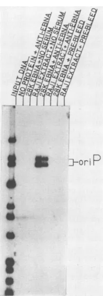 FIG.4.digestantiserumfragmentprobesay. Identification of DNA-binding activities by immunoas- DNA-binding reactions were immunoprecipitated with rabbit directed against the bacterially synthesized 28K EBNA or with preimmunization serum from the same animal