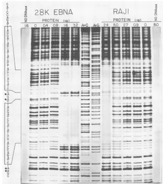 FIG. 6.the(lanesEBNA DNase I footprinting analysis: protection of a dimer of the EBNA-1 consensus binding site by the bacterially synthesized 28K fragment or by a heparin-agarose gradient fraction from Raji cells