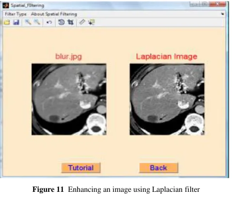 Figure 11  Enhancing an image using Laplacian filter 