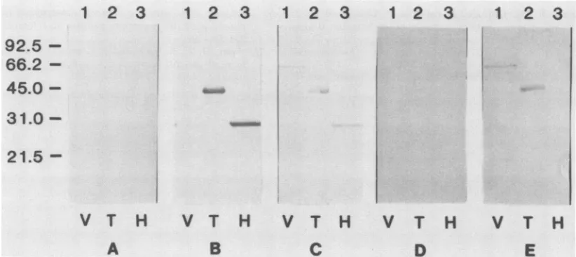 FIG. 4.forantiserum,(seeconcentratedAPH(3')I]serum Immunoblot identification of a HBV ORF P-encoded polypeptide
