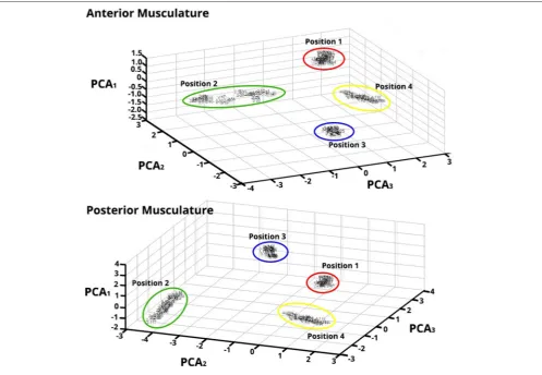 FIGURE 7 | Principal Component Analysis (PCA) for Feature Vectors (FV) after Data Were Trained applying SOFM—Forearm Flexor Musclesthat the thumb was opposed to