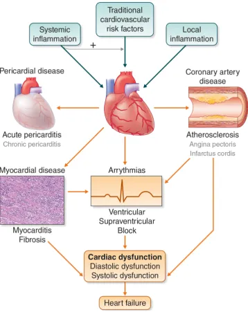 Figure 1Traditional cardiovascular risk factors can cause cardiac disease in patients with IIM