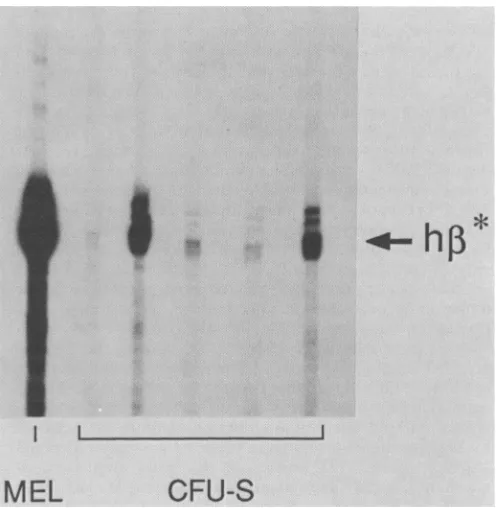 TABLE 3. P-Globin expression in MEL cells'