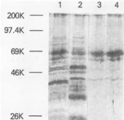 TABLE 1. Comparison of polymerase and RNase H activities ofviral and bacterially expressed MuLV reverse transcriptase