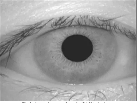 Fig 2: A sample image from the CASIA database 