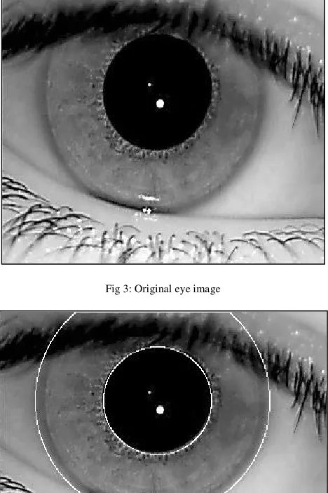 Fig 3: Original eye image 