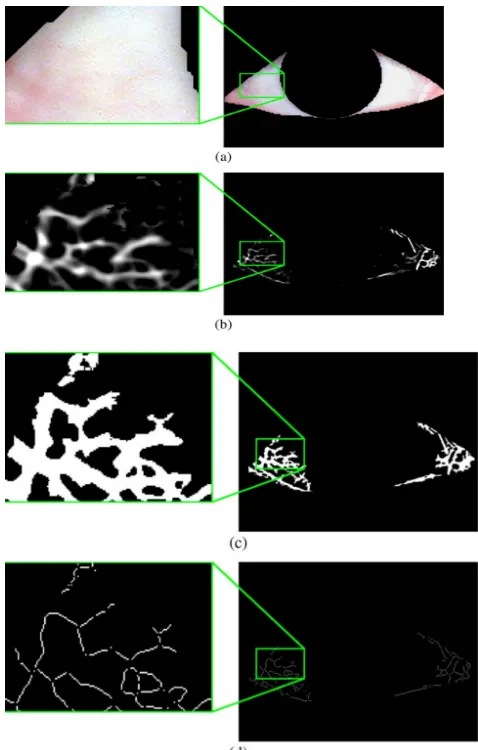 Fig. 5. Vessel patterns—before and after Gabor enhancement. (a) 