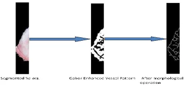 Fig. 6. Sclera Feature Extraction 